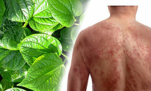 Bài thuốc dân gian trị ngứa da