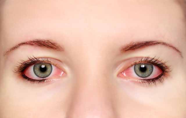 Đường lây của bệnh đau mắt hột