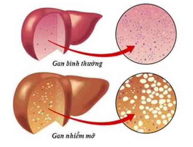 Bệnh đau nhức xương khớp và cách điều trị hiệu quả