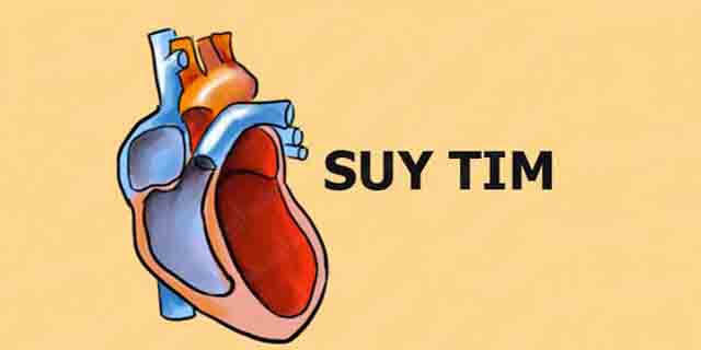 Bệnh suy tim triệu chứng và cách điều trị