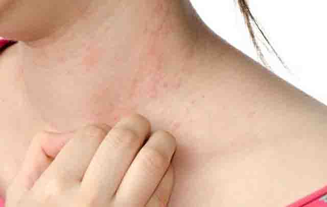 Biểu hiện của bệnh gan yếu