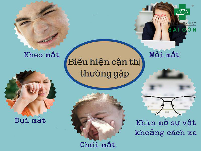 Biểu hiện của cận thị nhẹ