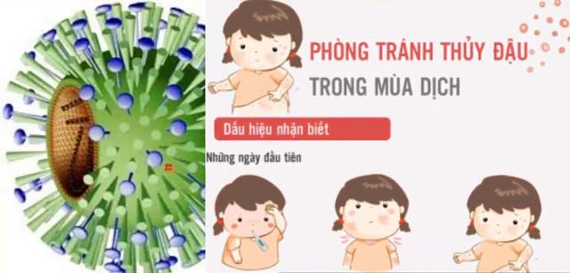 Cách phòng bệnh thủy đậu