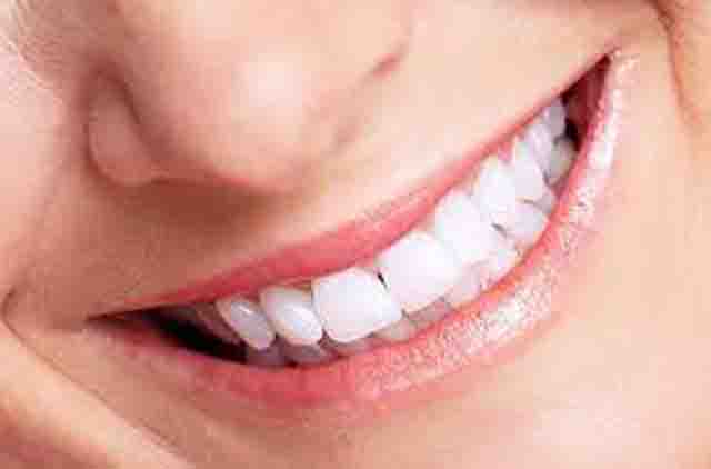 Cạo vôi răng và tẩy trắng răng bao nhiêu tiền