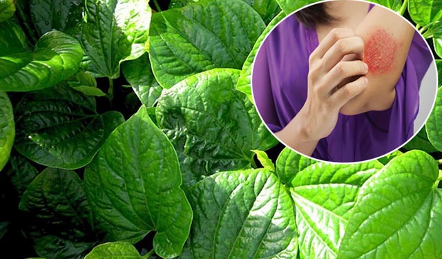Chữa viêm da cơ địa bằng lá lốt