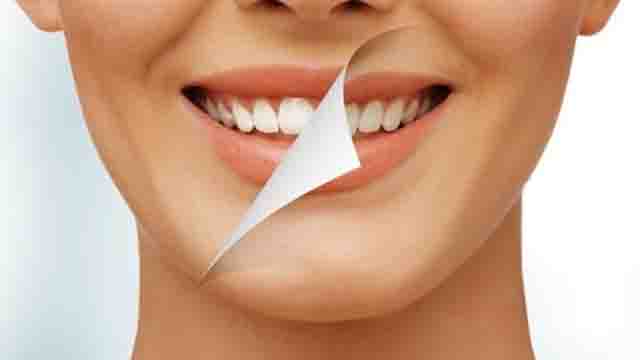 Cơ chế tẩy trắng răng