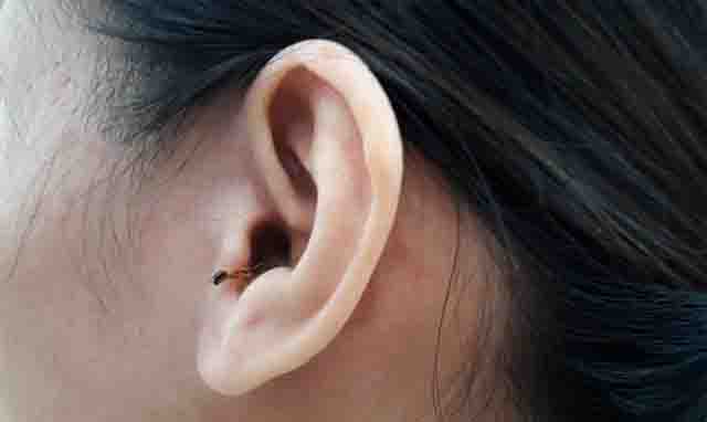 Cách chữa bệnh stress