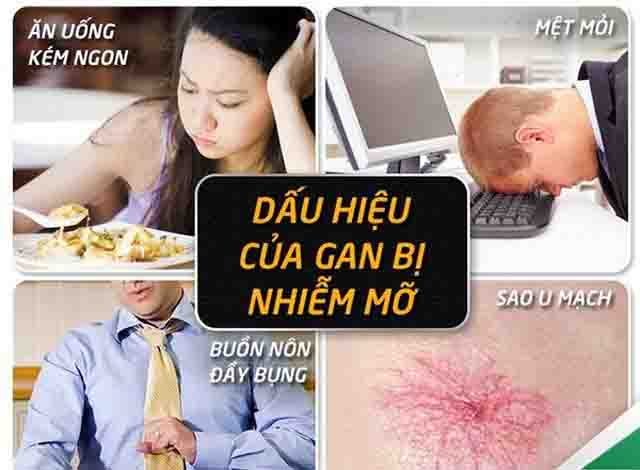Dấu hiệu bệnh gan nhiễm mỡ