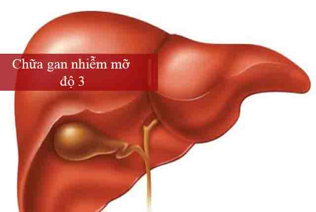 Điều trị gan nhiễm mỡ độ 3