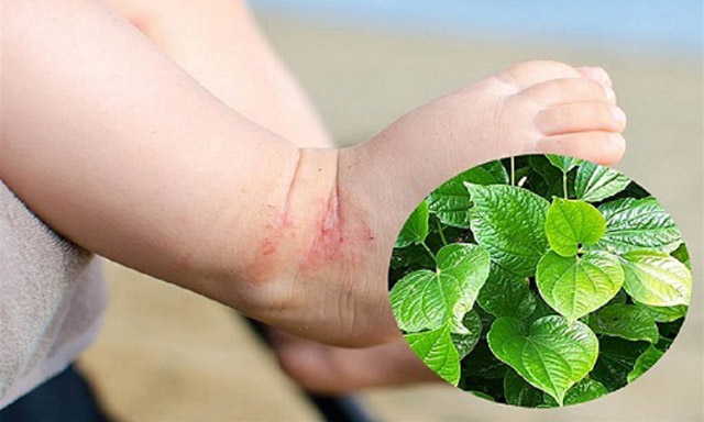 Lá tắm chữa viêm da cơ địa