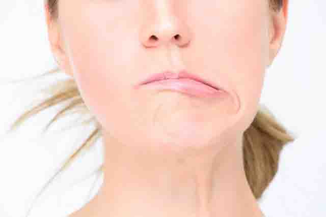 Ngủ dậy méo mặt - Dấu hiệu nhận biết ngủ dậy méo mặt, nguyên nhân