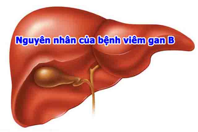 Nguyên nhân bị viêm gan B