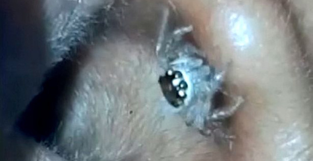 Nhện chui vào tai