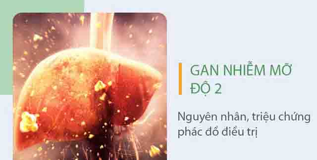 Phác đồ điều trị gan nhiễm mỡ độ 2