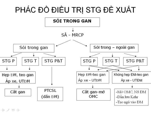 Phác đồ điều trị sỏi bàng quang