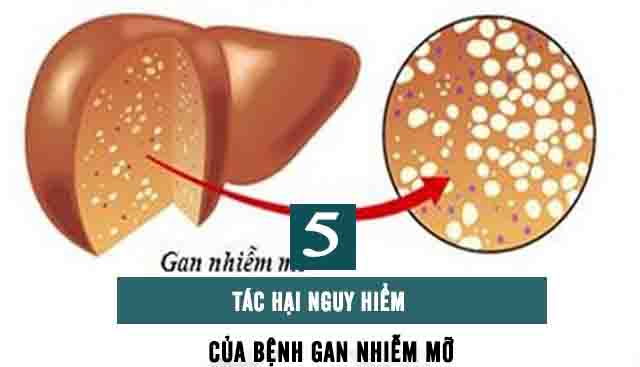 Tác hại của gan nhiễm mỡ