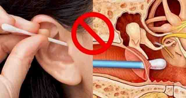 Ngoáy tai - Những tác hại khôn lường của việc ngoáy tai