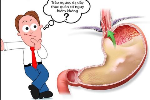 Bệnh trào ngược dạ dày có nguy hiểm không