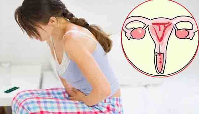 Ung thư cổ tử cung - Tìm hiểu dấu hiệu và các yếu tố nguy cơ
