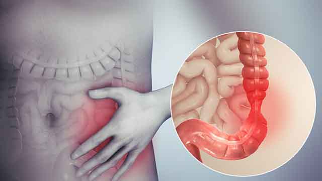 Viêm đại tràng co thắt uống thuốc gì