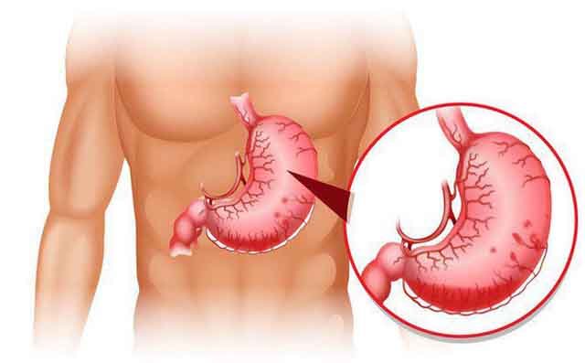 Viêm da cơ địa và cách điều trị hiệu quả
