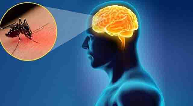 Bệnh viêm não Nhật Bản và cách điều trị hiệu quả