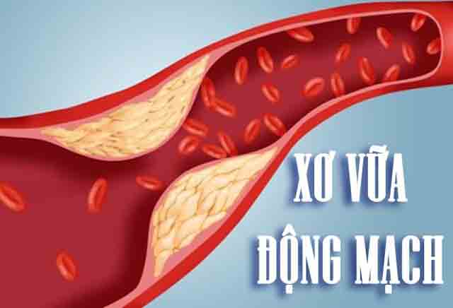 Thực phẩm chống xơ vữa mạch máu